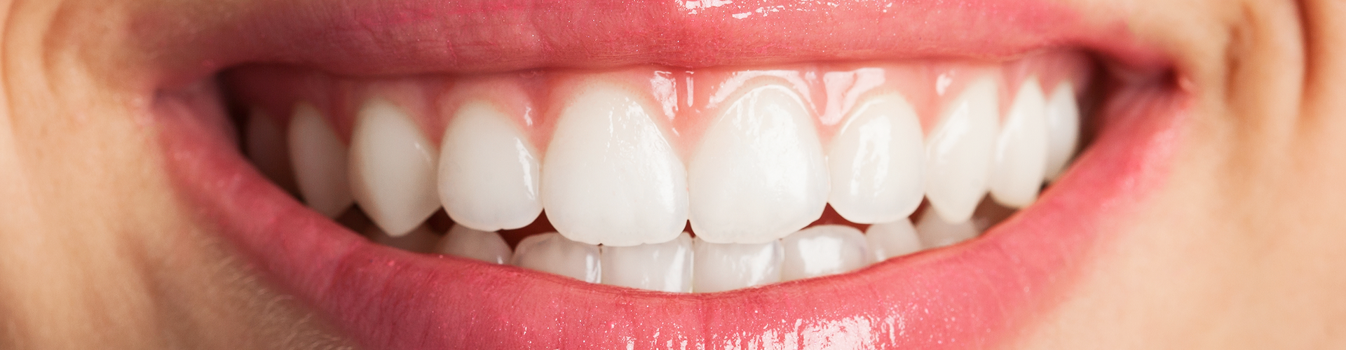 Close up of woman's smile.